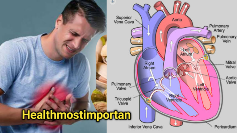 Acquired Heart Valve Disease