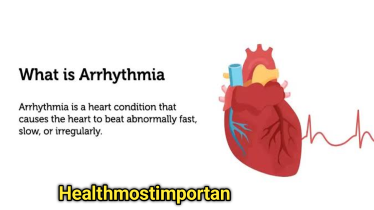 Signs And Symptoms Of Arrhythmia