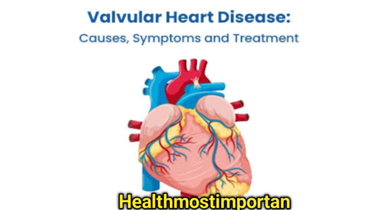 Signs And Symptoms Of Heart Valve Disease