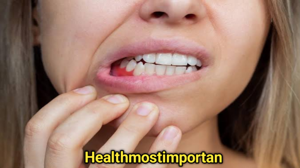 Degenerative Gum Disease Treatment 