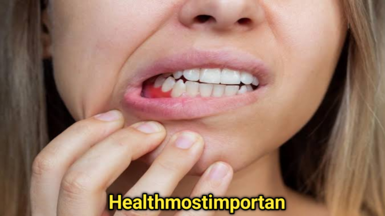 Degenerative Gum Disease Treatment